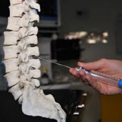 Demonstration of Epidural needle being injected into spine