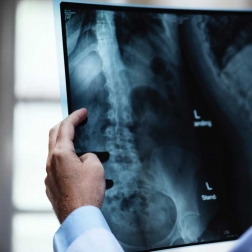 Settlement in a case against a physician for failing to order imaging studies.
